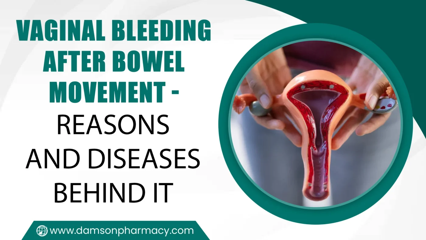 Vaginal bleeding after bowel movement - Reasons and diseases behind it